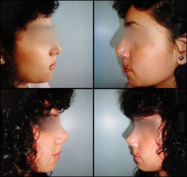 Ejemplo de un procedimiento realizado por el doctor González.